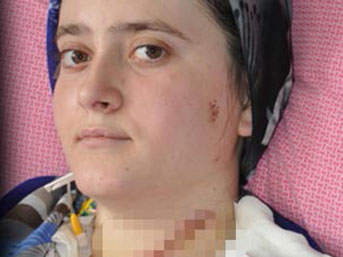 'Kurbanlık gibi boğazımı kesti'
