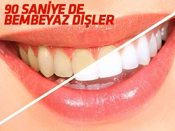 Sadece 90 Saniyede bembeyaz dişler