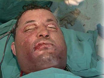 [Resim: yuz-nakli3.jpg]