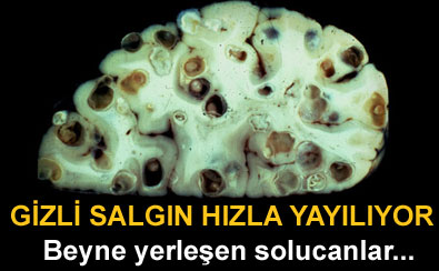 Gizli salg�n h�zla yay�l�yor