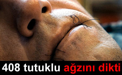 408 tutuklu a�z�n� dikti