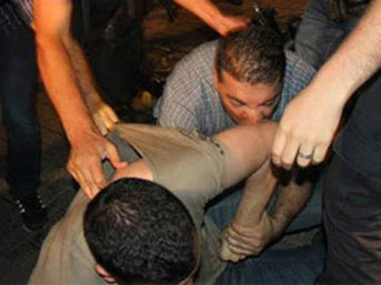 Polis göstericiyi böyle ısırdı