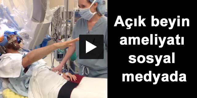 A��k beyin ameliyat� sosyal medyada