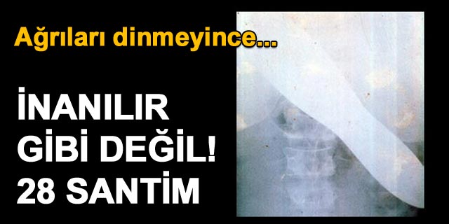 28 santimlik 'mala' karn�nda unutuldu